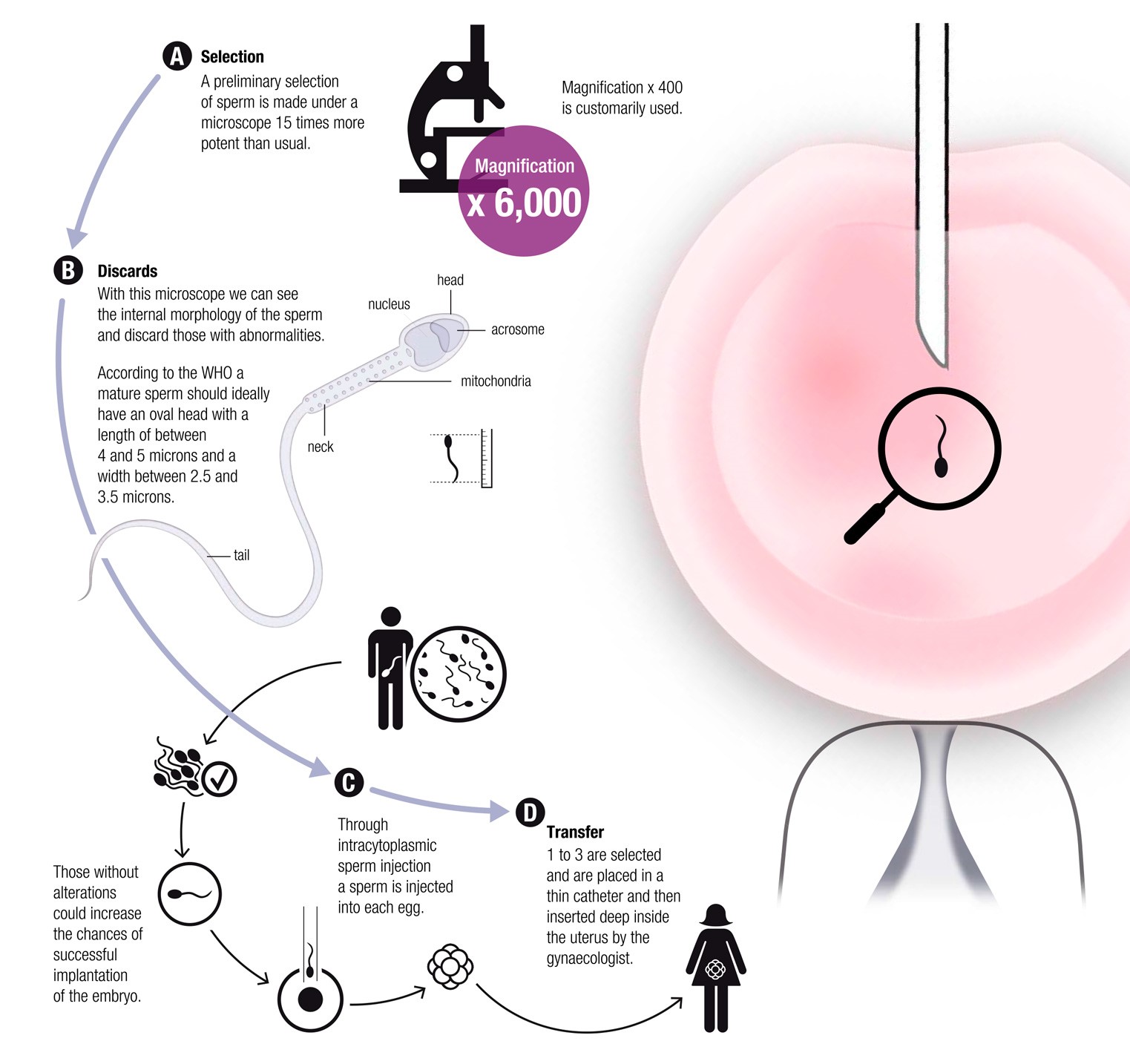 How Can IMSI Used With IVF Help You? - Bridge Clinic